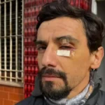 Gonzalo casi pierde un ojo por el asalto en 64 entre 20 y 21