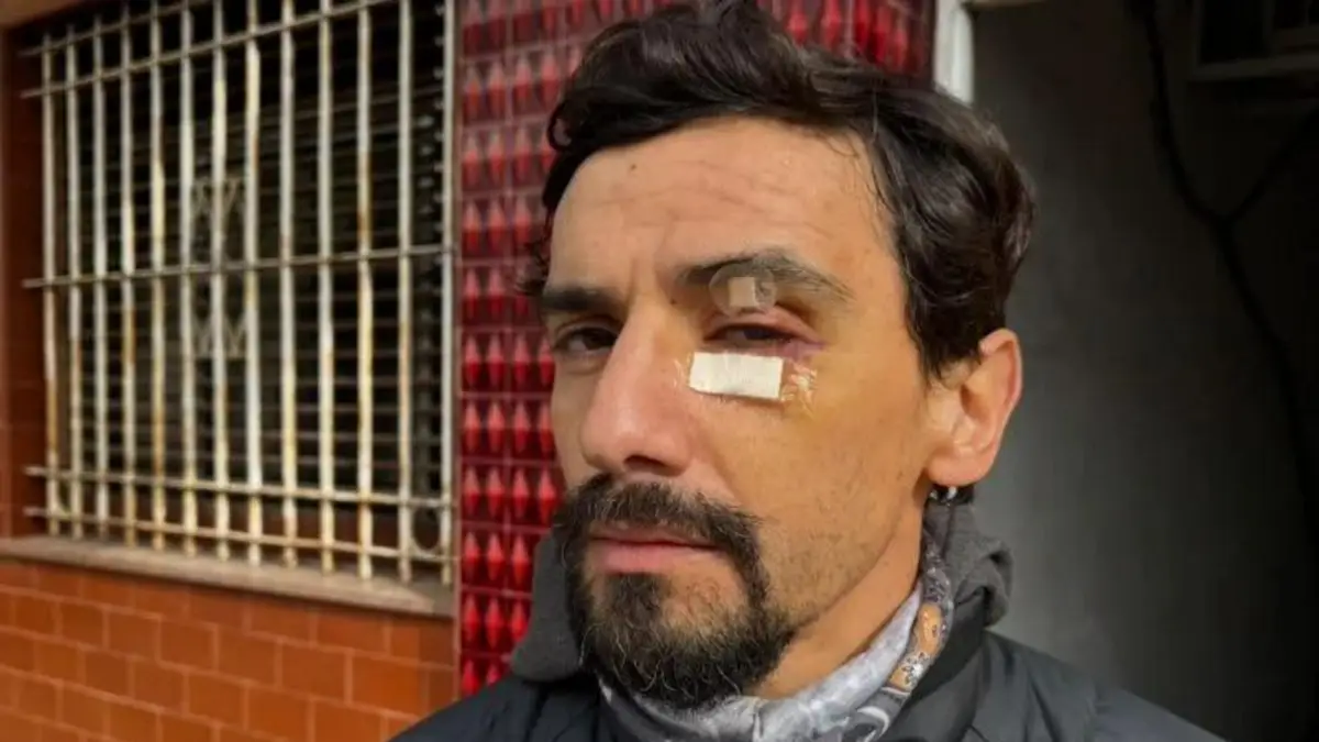Gonzalo casi pierde un ojo por el asalto en 64 entre 20 y 21